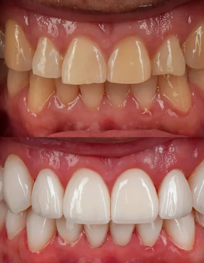 perfect smile in Florida